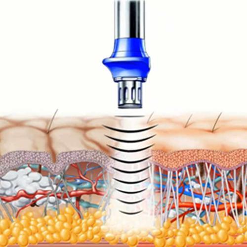 BTL X-WAVE CENTRE ESTHÉTIQUE : DOCTEUR NASSER MADI - médecine esthétique