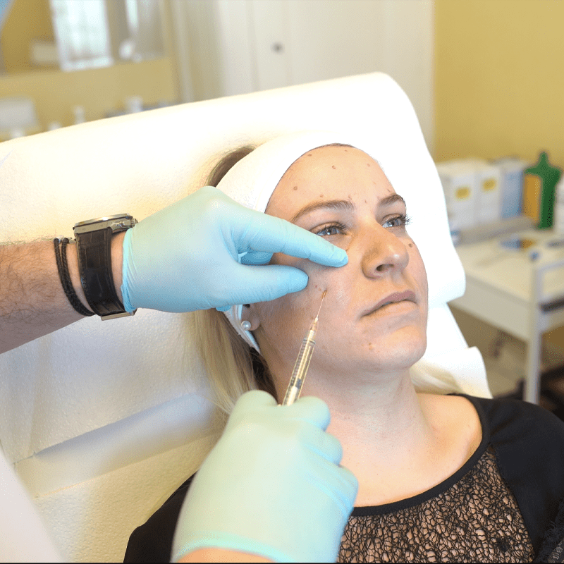 CERNES, CREUX, ET CONTOUR DES YEUX CENTRE ESTHÉTIQUE : DOCTEUR NASSER MADI médecine esthétique