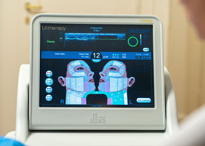 Lifting aux ultrasons Ultherapy Genève Prix