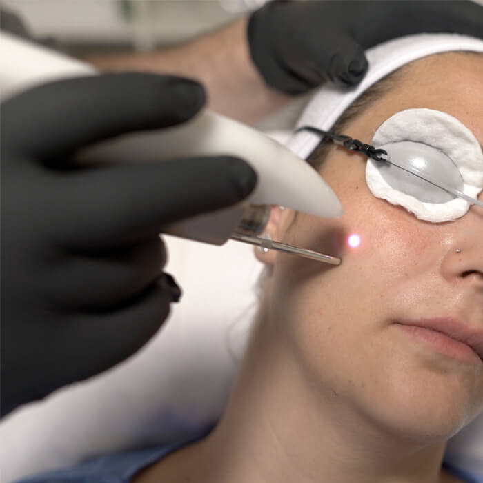 Fotona 3D 4D CENTRE ESTHÉTIQUE : DOCTEUR NASSER MADI - FMH médecine esthétique 