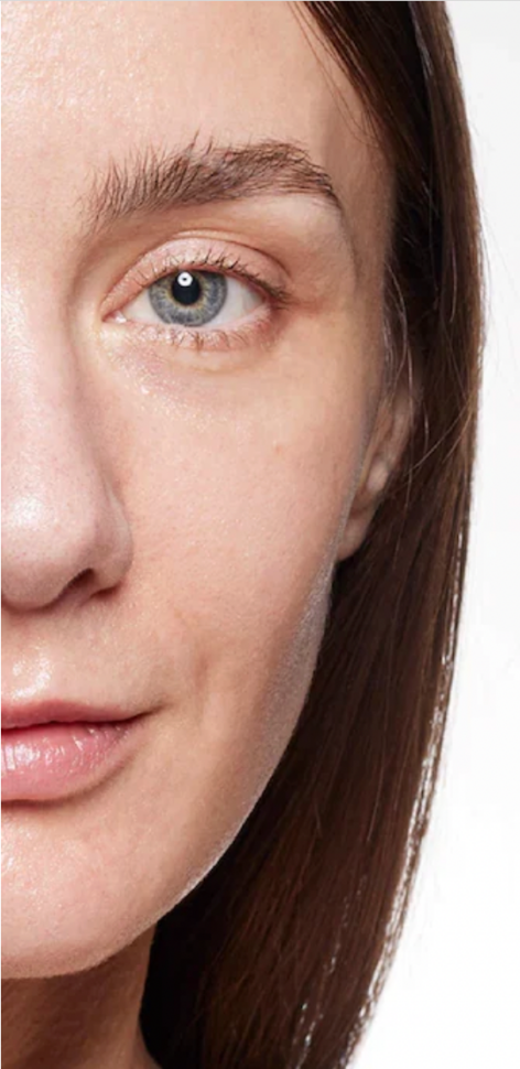 Gros plan sur la moitié du visage d'une femme à la peau lisse et hydratée, mettant en valeur les résultats d'un traitement Rejuran.